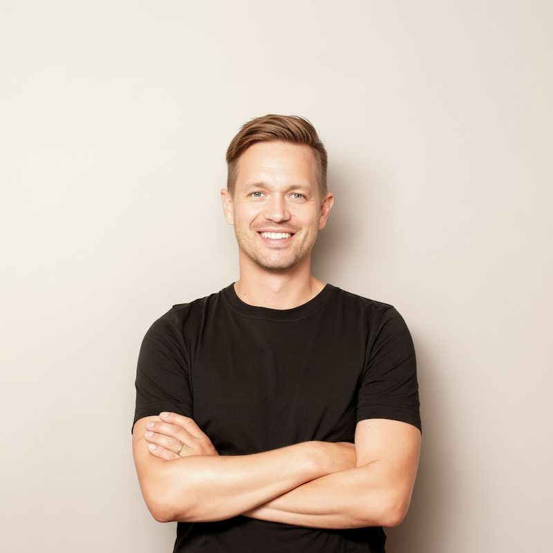 Hair transplant after result - happy client